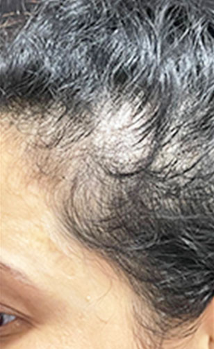 Before-2
