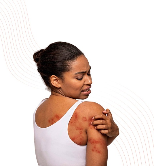 Dermatitis & Eczema