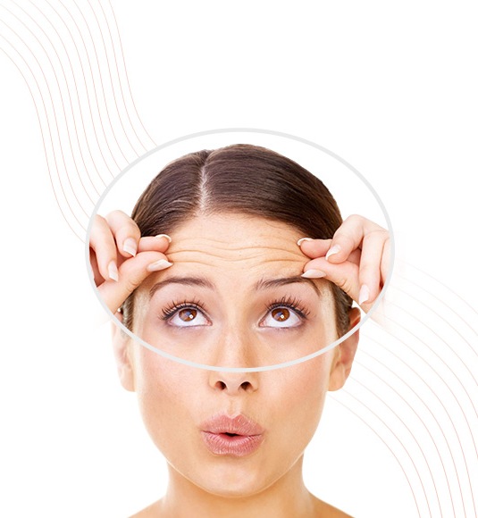 Forehead Lines