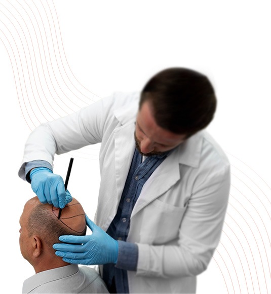 Hair Transplant