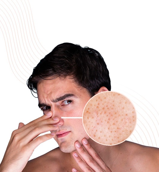 Open Pores & Texture