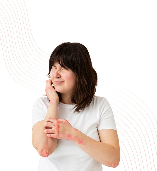 Psoriasis Treatment