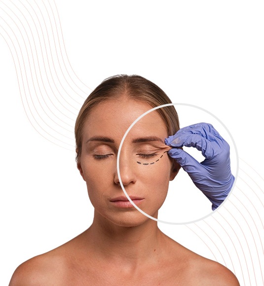 Tear Trough Filler