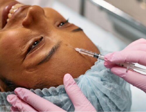 Botox — What It Actually Does, What It Doesn’t, and Who Needs It