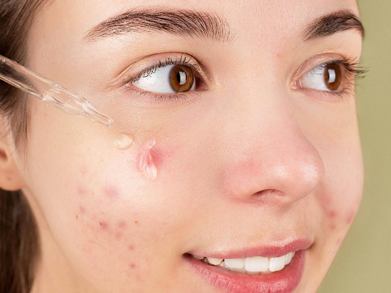 Retinol vs Retinoid