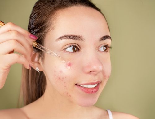 Acne Scar Treatment — Which Option Is Right for Your Scar Type