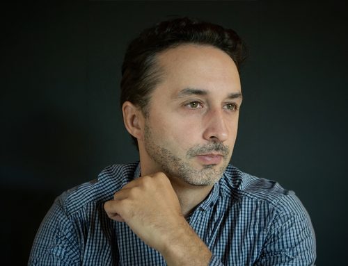 Hair Transplant — Who Is a Candidate and What to Realistically Expect