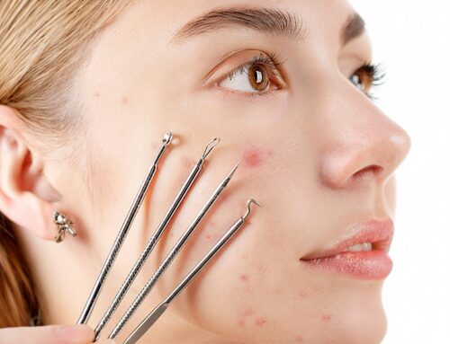 MNRF — Microneedling Radiofrequency for Scars and Skin Tightening