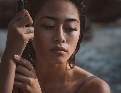 Melasma — Why It Keeps Coming Back and How to Actually Manage It