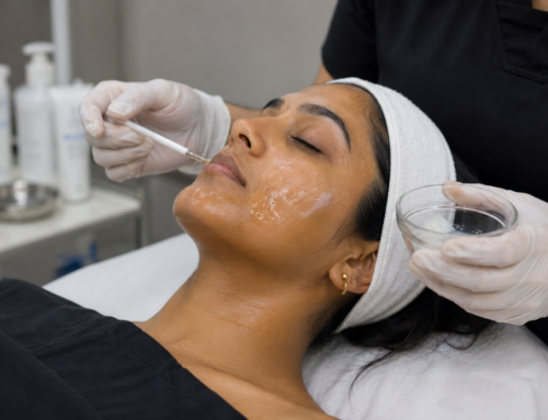 Top 5 Dermatologist-Approved Tan Removal Treatments in 2026