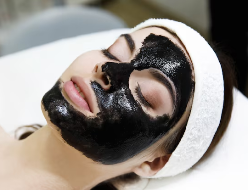 7 Things to Know About Carbon Peel Treatment